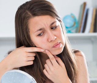 Online Doctor Consultation For Acne- Pimples