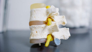 Bone health