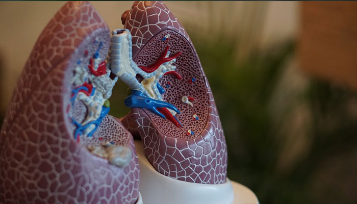 Alternative Medicine for Kidney Stones
