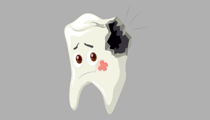 tooth decay
